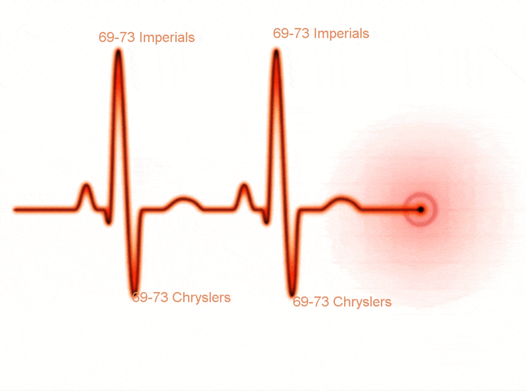 ekg.gif