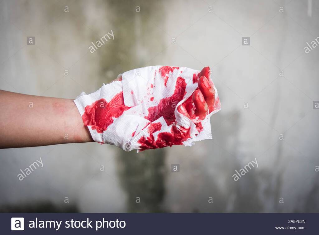 medicine-bandage-with-very-bloody-red-injury-man-hand-after-accident-2A5Y52N.jpg